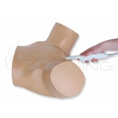 General Pathology Transvaginal Ultrasound Tra