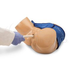 Combo Intrauterine and Ectopic Pregnancy Tran