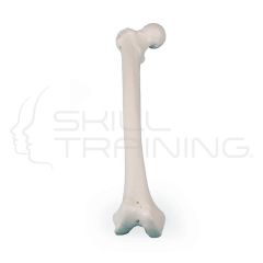 Right Femur