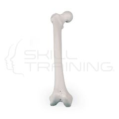Left Femur