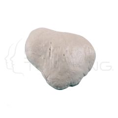 Left Patella (Kneecap)