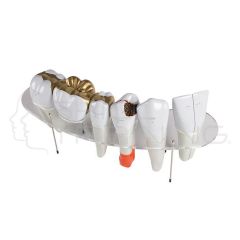 Morfología serie dental, de 7 partes, 10 vece