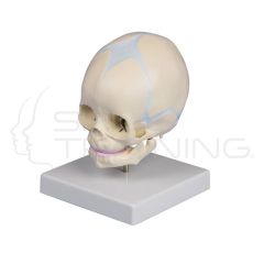 Fetus skull