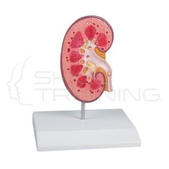 Kidney Model- Normal and Pathology