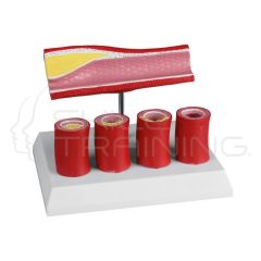 Artery with 4 artery sections