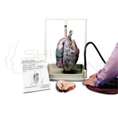 Smokers Lung Model