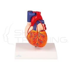 Heart with Bypass