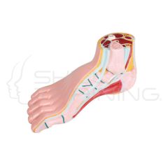 Hollow Foot, Pes Cavus