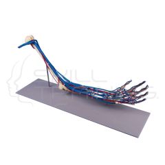 Skeleton of Arm with Vessels