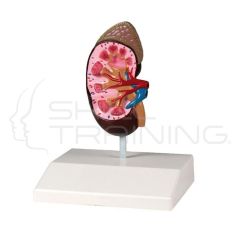 Kidney Model, Life Size