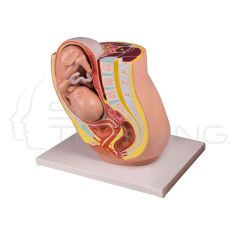 Pregnancy Pelvis with Fetus in the 32nd week of Pregnancy, 2 Parts