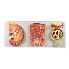 Sección de Riñón con Nefrona Renal y Corpúsculo Renal