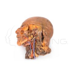 Seccion sagital de cabeza y cuello con diseccion de la fosa infratemporal