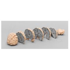 Cerebro Humano Multiples Secciones Frontales