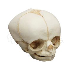 Craneo fetal de 30 semanas