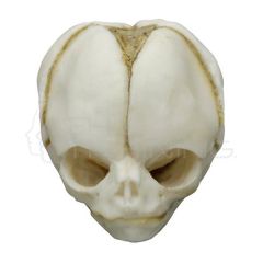 Craneo fetal de 20 semanas