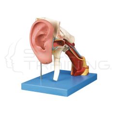 Enlarged Ear