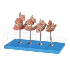 Development of a Set of Teeth