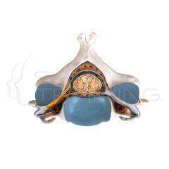 Fifth Cervical Vertebra with Spinal