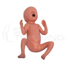 Bebe Prematuro de 24 Semanas