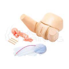 10 cordones umbilicales para onfalotomia
