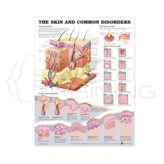 The Skin Chart