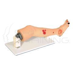 Annie Arterial Insufficiency Leg