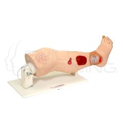 Vinnie Venous Insufficiency Leg