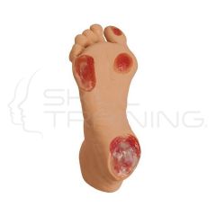 Life/form Elderly Pressure Ulcer Foot-Light