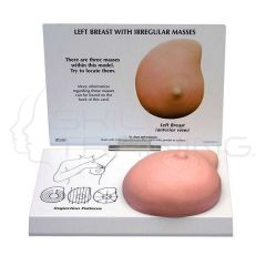 Left Breast with Cancer Model