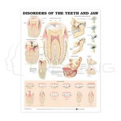 Disorder of the Teerh and Jaw Chart