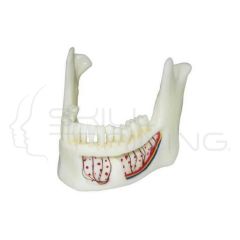 Mandíbula Inf. Tam. Natural Con Placa Dental