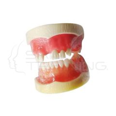 Modelo Implante Dental