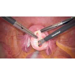 VirtaMed GynoS™ Gynecological Laparoscopy Module (4)