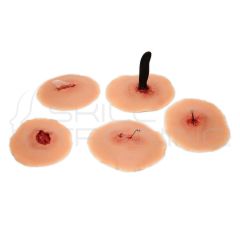 Set of 5 sticky wounds with foreign body