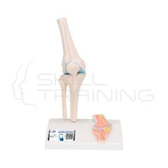 Modelo de anatomia de la rodilla tamano reducido