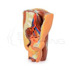 Pelvis izquierda y muslo proximal masculinos impresos en 3D
