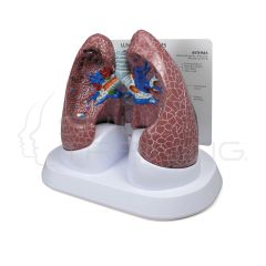 Set de Pulmones con Patologías