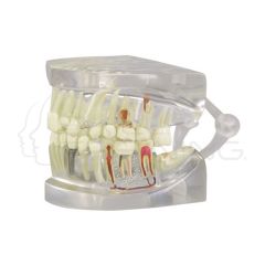 Modelo Mandibula Humana Transparente con Dientes