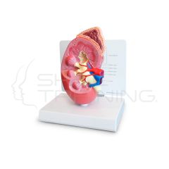 Modelo de Rinon con Glandula Adrenal 2x Tamano Natural - 2 partes