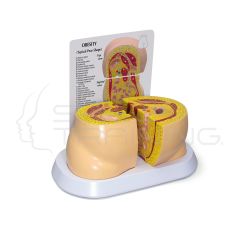 Modelo Anatomico de Obesidad