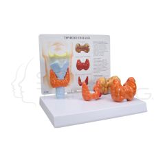 Modelo de Anatomia de la Enfermedad Tiroidea