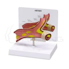 Modelo Anatomico Arteria con Seccion en Y