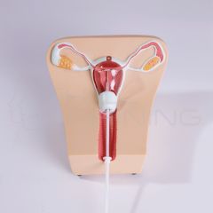 Inserción y Extracción de DIU Modelo 1-  Modelo Anatómico con Base