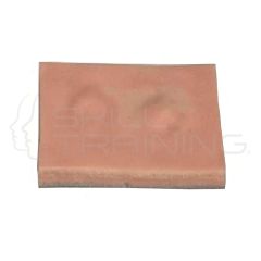 Modelo de Resección de Lipoma - Pad