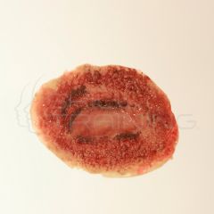 Moulage de Quemadura de Fuego